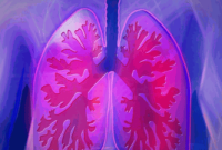 7 Effective Ways to Prevent Lung Diseases