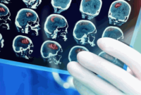 Understanding the Different Stages, Symptoms, and Diagnosis of Brain Cancer