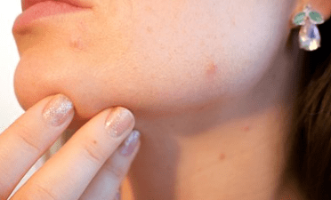 How to Identify and Care for Sensitive Skin: Tips and Tricks